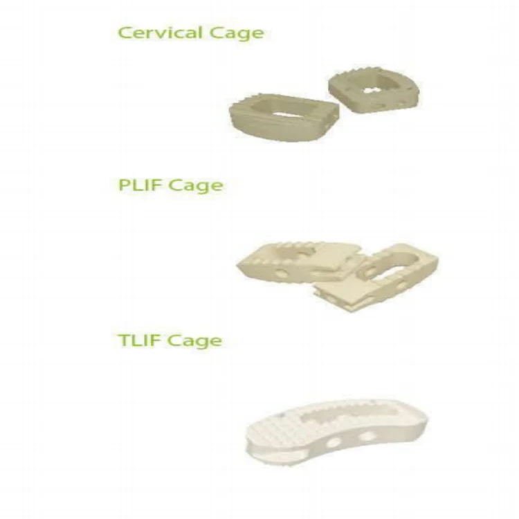 peek spinal implant